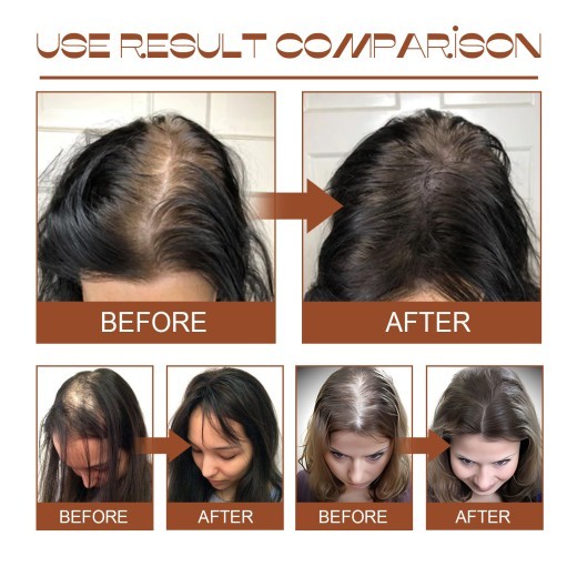 Hair Conditioner Pure Batana Oil Straightening Smoothing Hair Mask Anti Hair Loss Treatments Split Ends Damaged Fluffy Hair