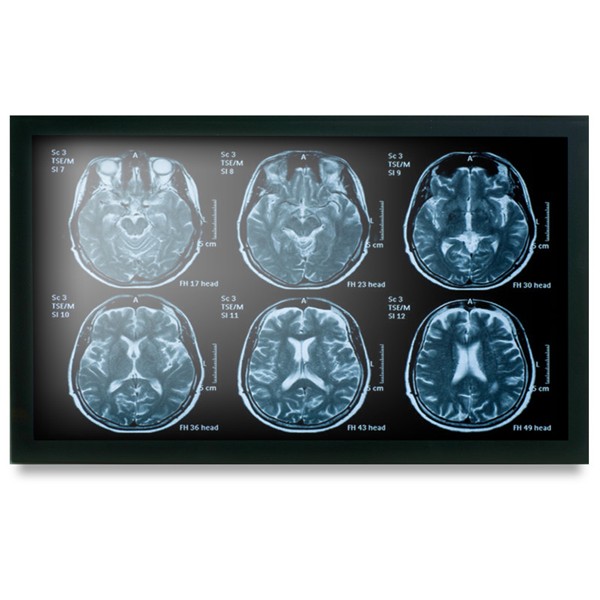 Onyx MEDDP-622HNN 21.5" Medical Display