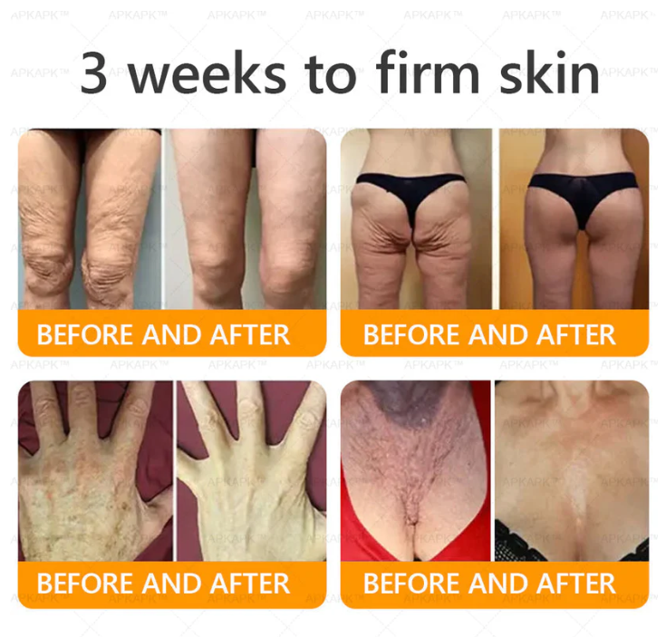 AWZLOVE Bee Venom Comprehensive Cream