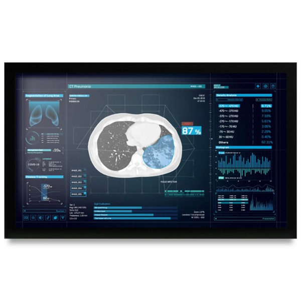 Onyx MEDDP-627HNN 27" Medical Display