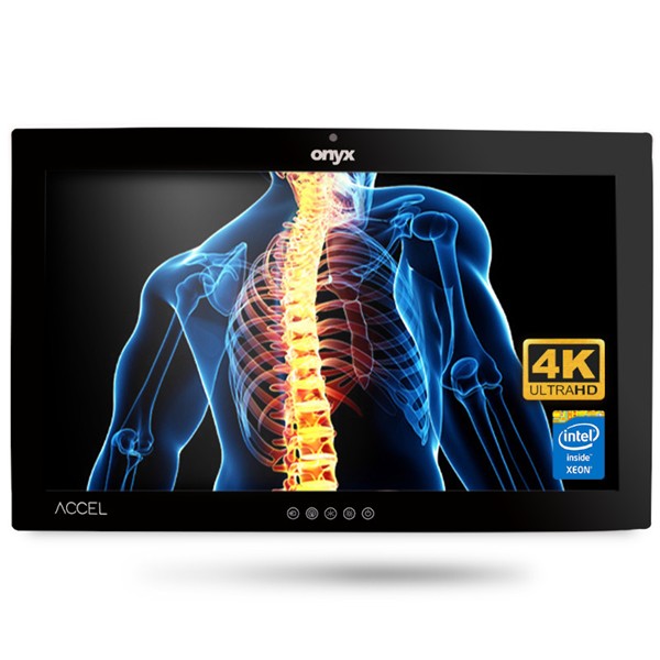 Onyx ACCEL-A2701 i7 27" 4K OR Station PCAP Touch