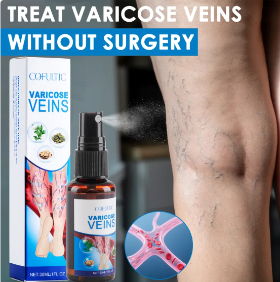 Varicose Vein Relief Spray (Non-Surgical Support)