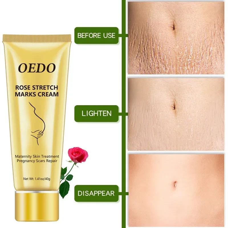 OEDO Rose screctch Marks Cream
