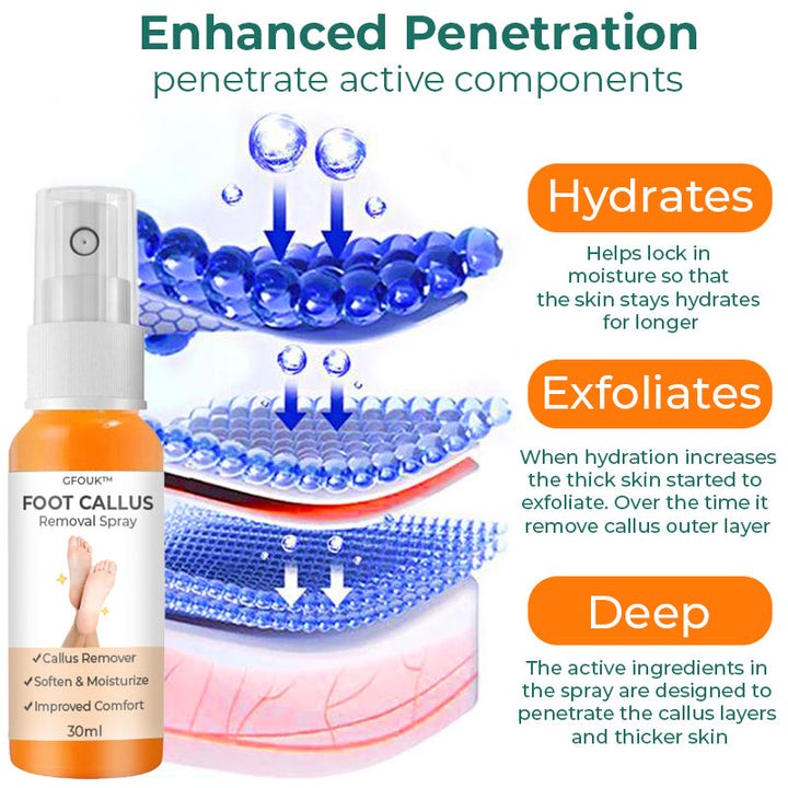 Foot Callus Removal Spray GFOUK