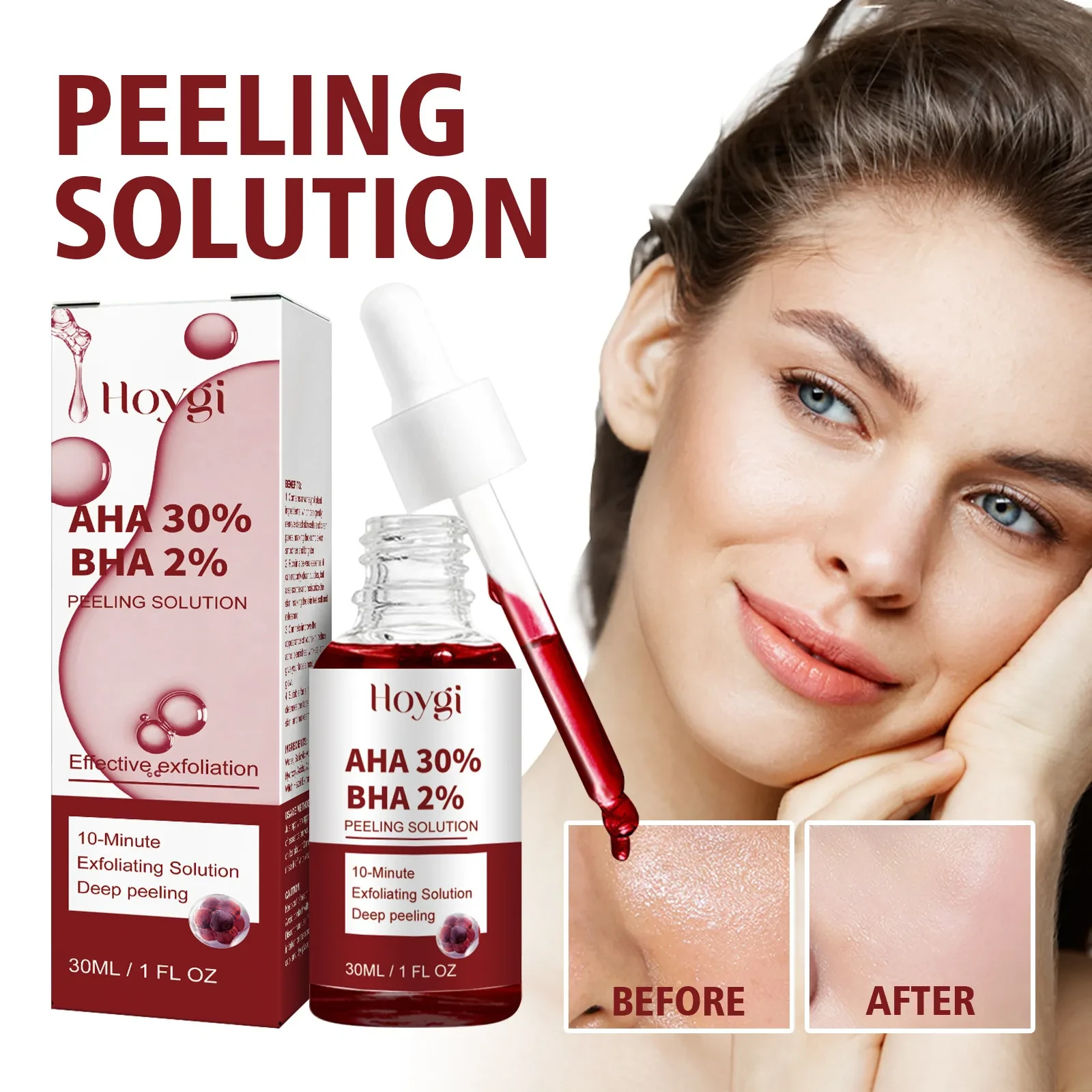 Hoygi AHA 30% BHA 2% Peeling Solution