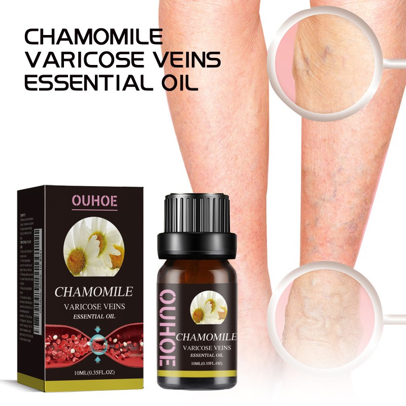 Ouhoe Chamomile Varicose Veins Essential Oil  Natural Treatment for Smooth, Healthy Legs
