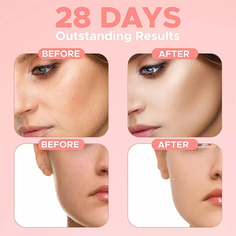 Carvenchy 4-in-1 Facial Serum