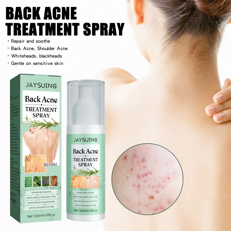 Jaysuing Back Acne Repair Spray, Repair Body Acne Fade Acne Mark Skin Care Spray