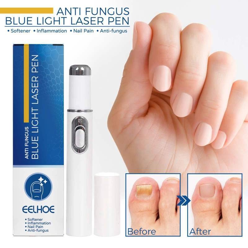 EELHOE Nail Blue Light Laser Pen Simple And Easy