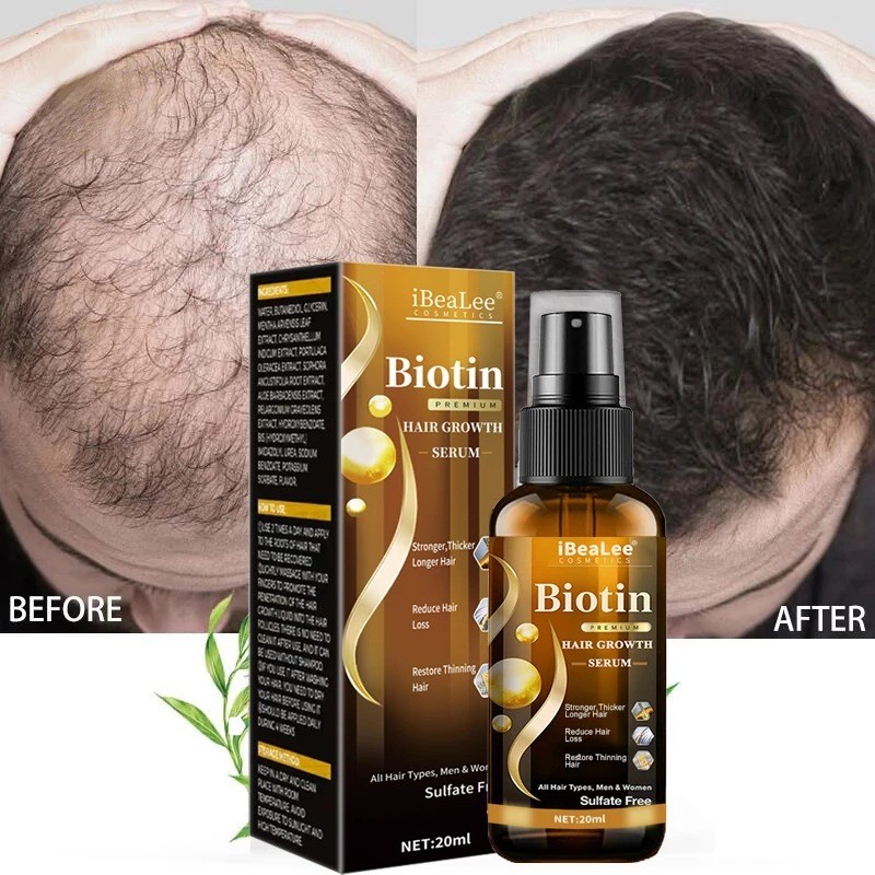 Biotin Hair Growth Serum