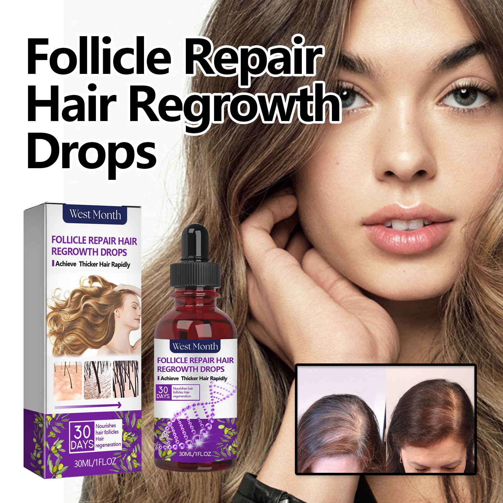 West Month Follicle Repair Hair Regrowth Drops