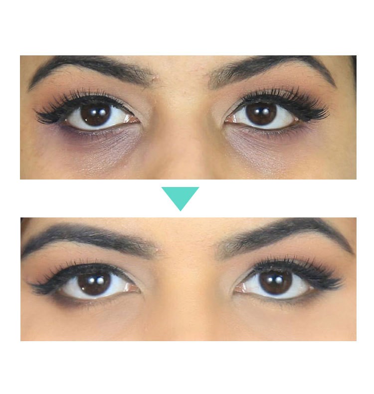 AnYi Beauty Eye Cream Target Dark Circles, Puffiness, and Fine Lines