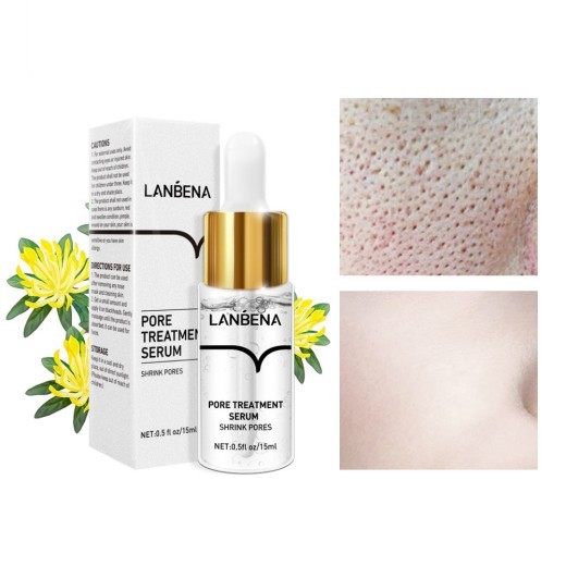 LANBENA Hair Kong 15ml