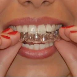 2pcs/4pcs Sports Mouth Guards - Ultimate Sleep Teeth Guard - Prevents Grinding, Tooth Damage - BPA-Free, Custom Fit for Snore-Free Nights