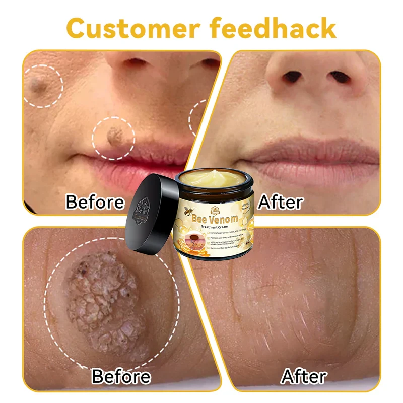 LOVILDS Bee Venom Skin Treatment CreamHealth Canada Approved