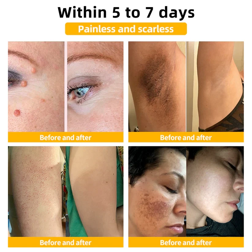 LOVILDS Bee Venom Skin Treatment CreamHealth Canada Approved