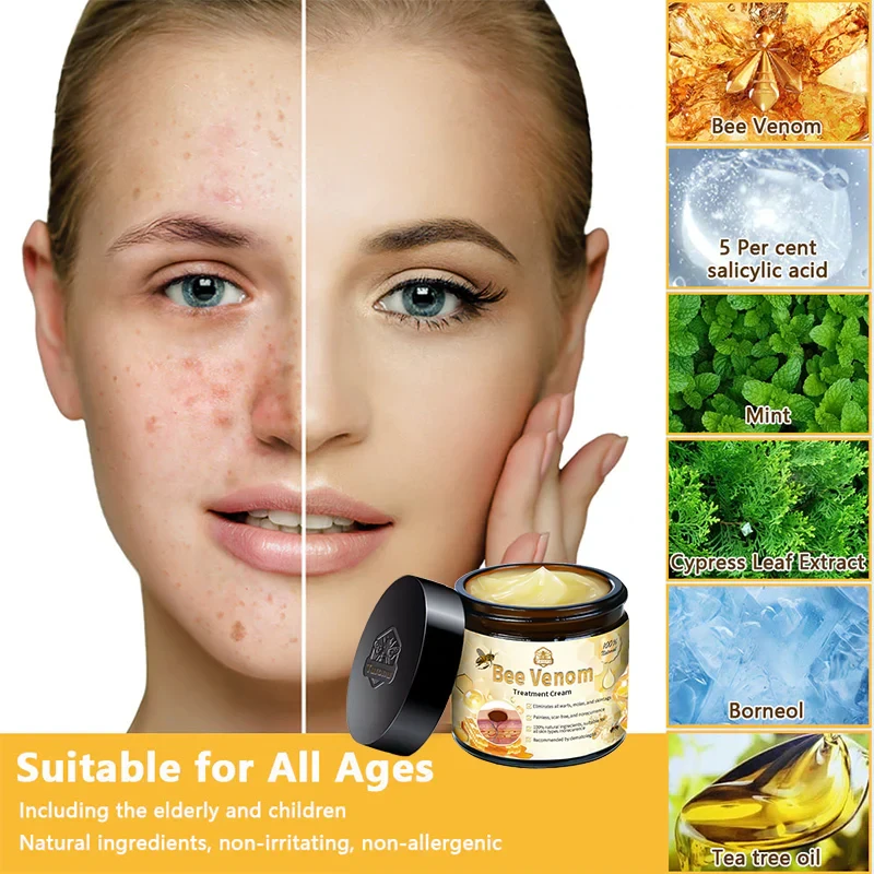 LOVILDS Bee Venom Skin Treatment CreamHealth Canada Approved