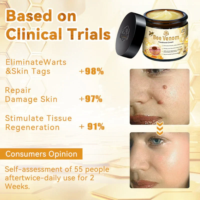 LOVILDS Bee Venom Skin Treatment CreamHealth Canada Approved