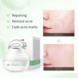 Herbal lotion Moisturizing Facial Cream