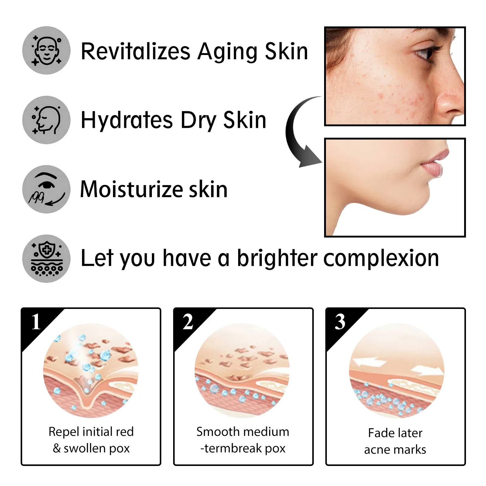 Snail Cream Fading Wrinkle French Lines Replenishment