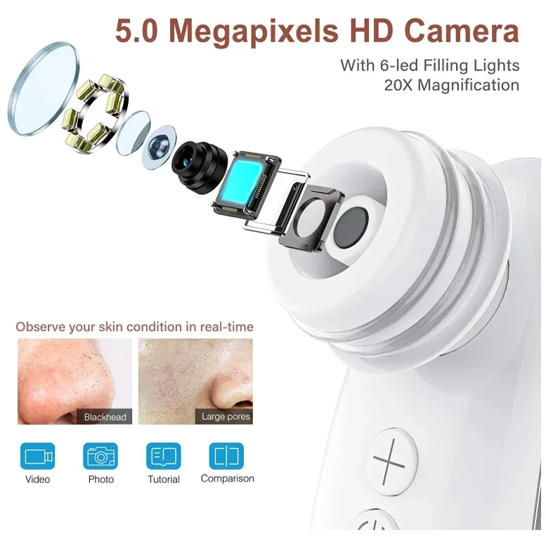 Visualized Blackhead Device Electric