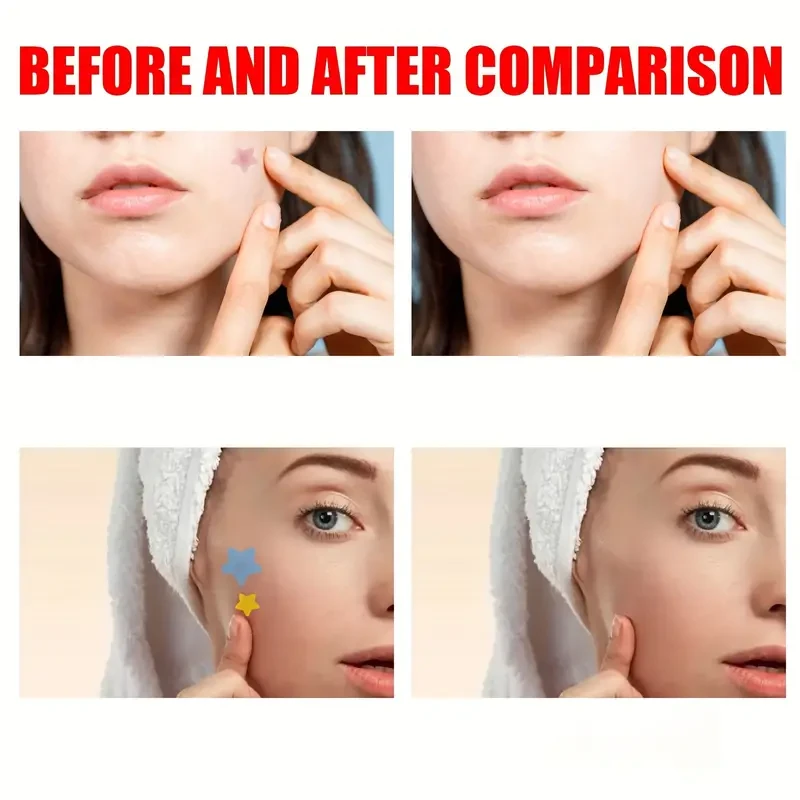 Fashion Star Colored Skincare Patch