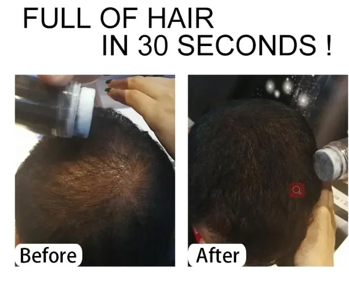 Hair Building Fibers Keratin Thicker Anti Hair Loss Products Concealer Refill Thickening Fiber Hair Powders Growth