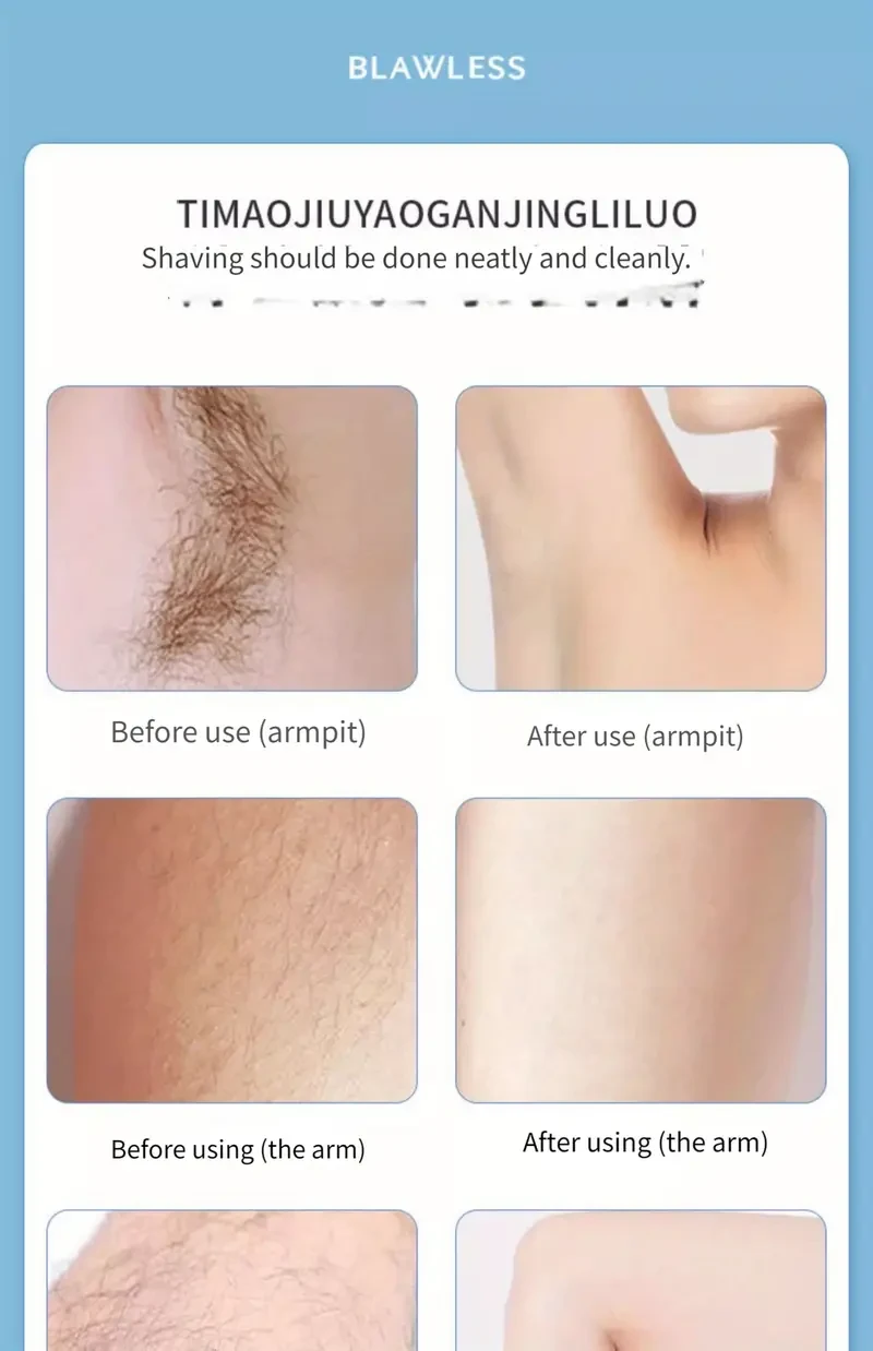 3-in-1 Deluxe Hair Removal Kit for Women - Rechargeable Electric Shaver for Facial, Nose, and Full-Body Epilation - Perfect Gift for Ladies with Smooth Skin Concerns