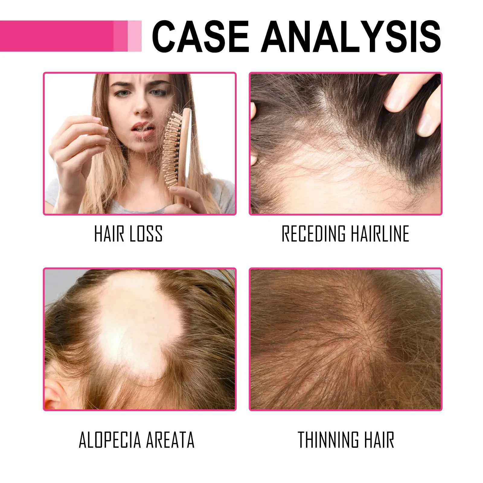 Essential Oil Moisturizing And Repairing Dry And Frizz