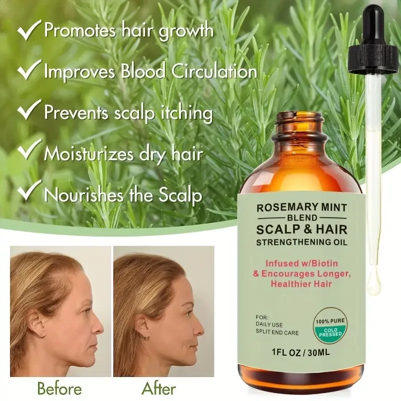 Rosemary Hair Growth Oil, Scalp And Hair Strengthening Oil For Hair Growth, Repair Dry, Damaged Hair, Restore Healthy Hair, Increase Shine, Contains Botanical Extracts, Hair Care Oil For All Hair Types.