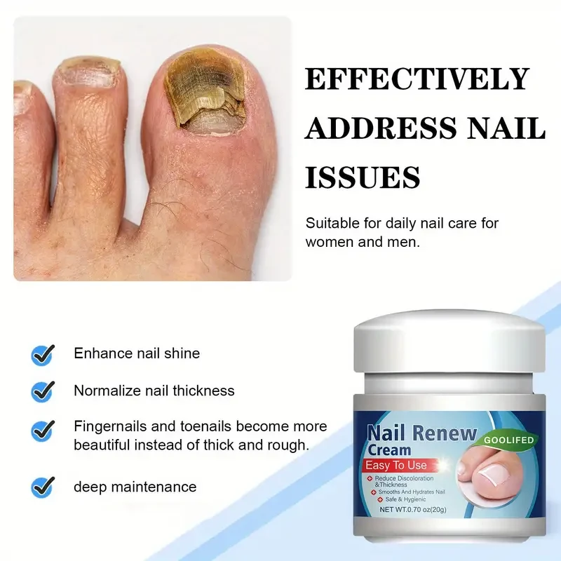 20g Nail Renewal Cream - Strengthens & Thickens Discolored, Yellowed Nails with Glycerin & Lactic Acid for Healthy Growth