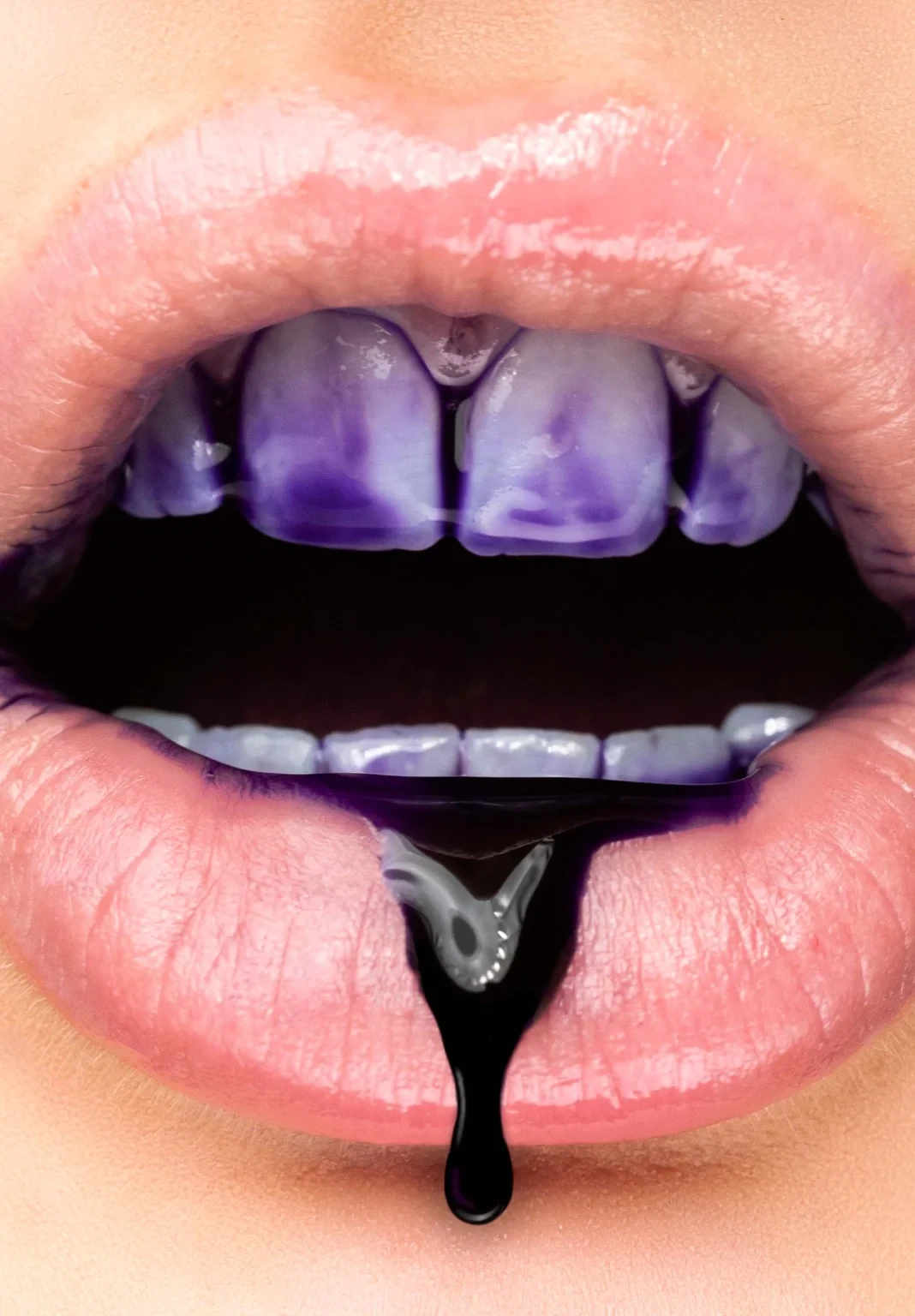 Teeth colour whitening