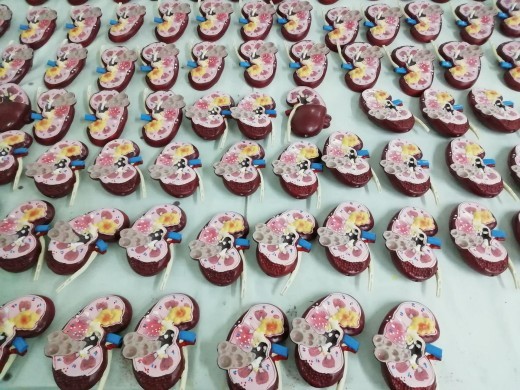 Anatomical Model Of Kidney Stone Pet Dog Lesion