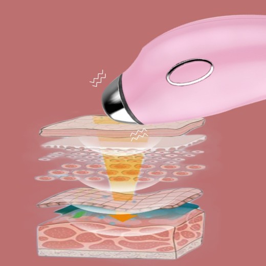 Heating To Remove Eye Lines Massage PE Face