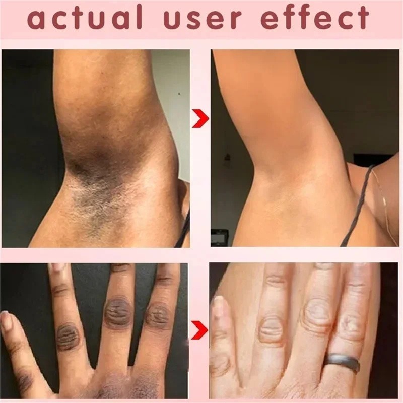 Body Whitening Cream - Intimate Area Brightening Lotion