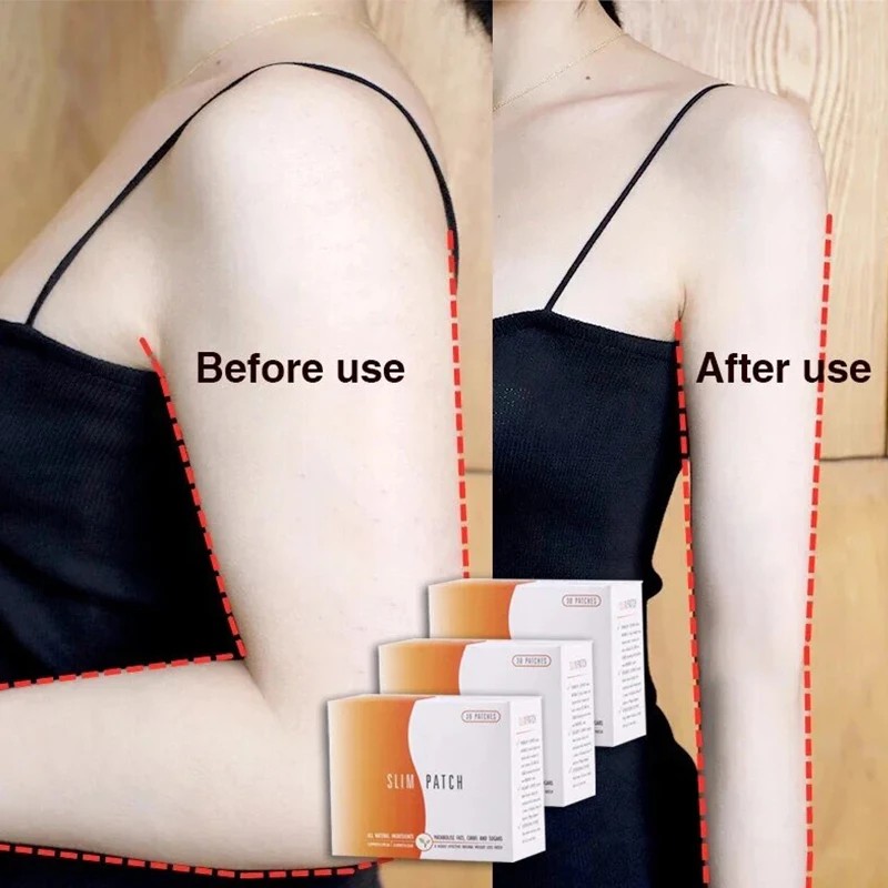 Slimming Navel Patch - 10pcs Burn Fat Waist and Belly Weight Loss