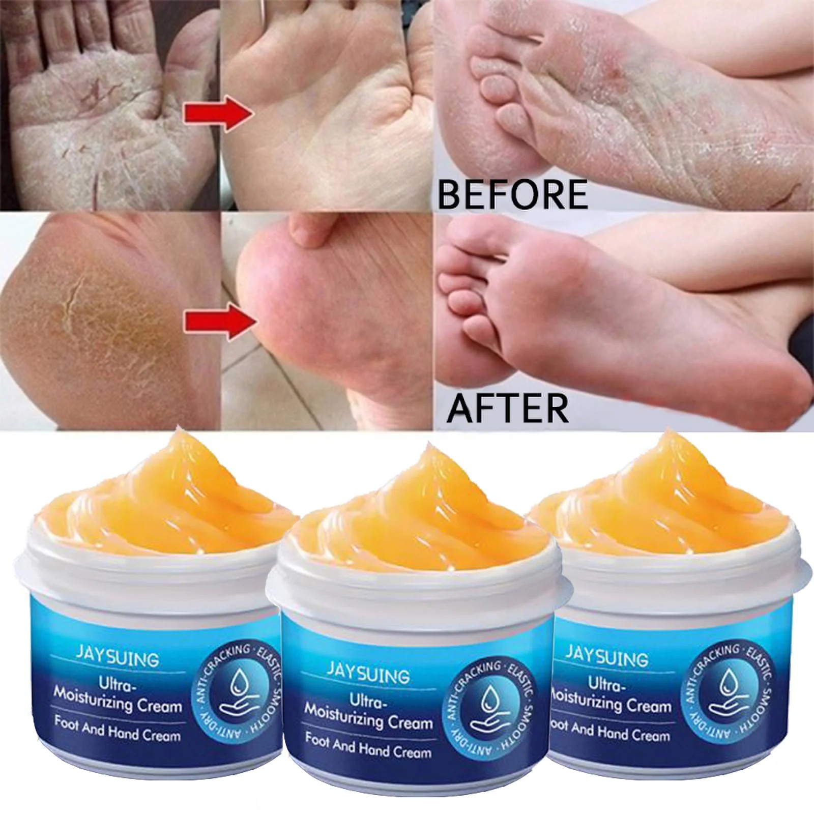 Anti-Drying Crack Hand & Foot Care Cream - Heel Repair & Skin Moisturizer