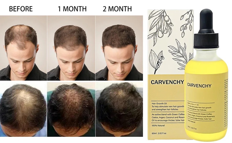 Veganic Natural Hair Growth Oil - Anti Hair Loss and Nourishing Essential Oil for Hair Thickening and Repair