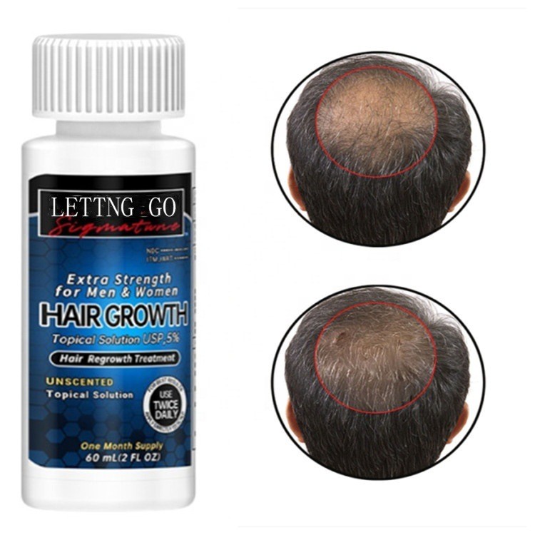 Thick And Fluffy Hairline