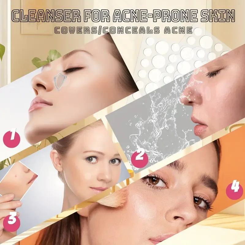 144 PCS Count Pimple Patch