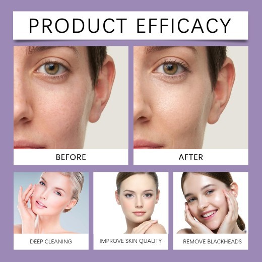 Pore Cleaning Compound Film Stick Gentle Moisturizing