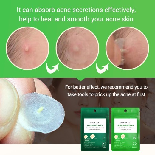 Tea Tree Acne Patch For Day And Night Use