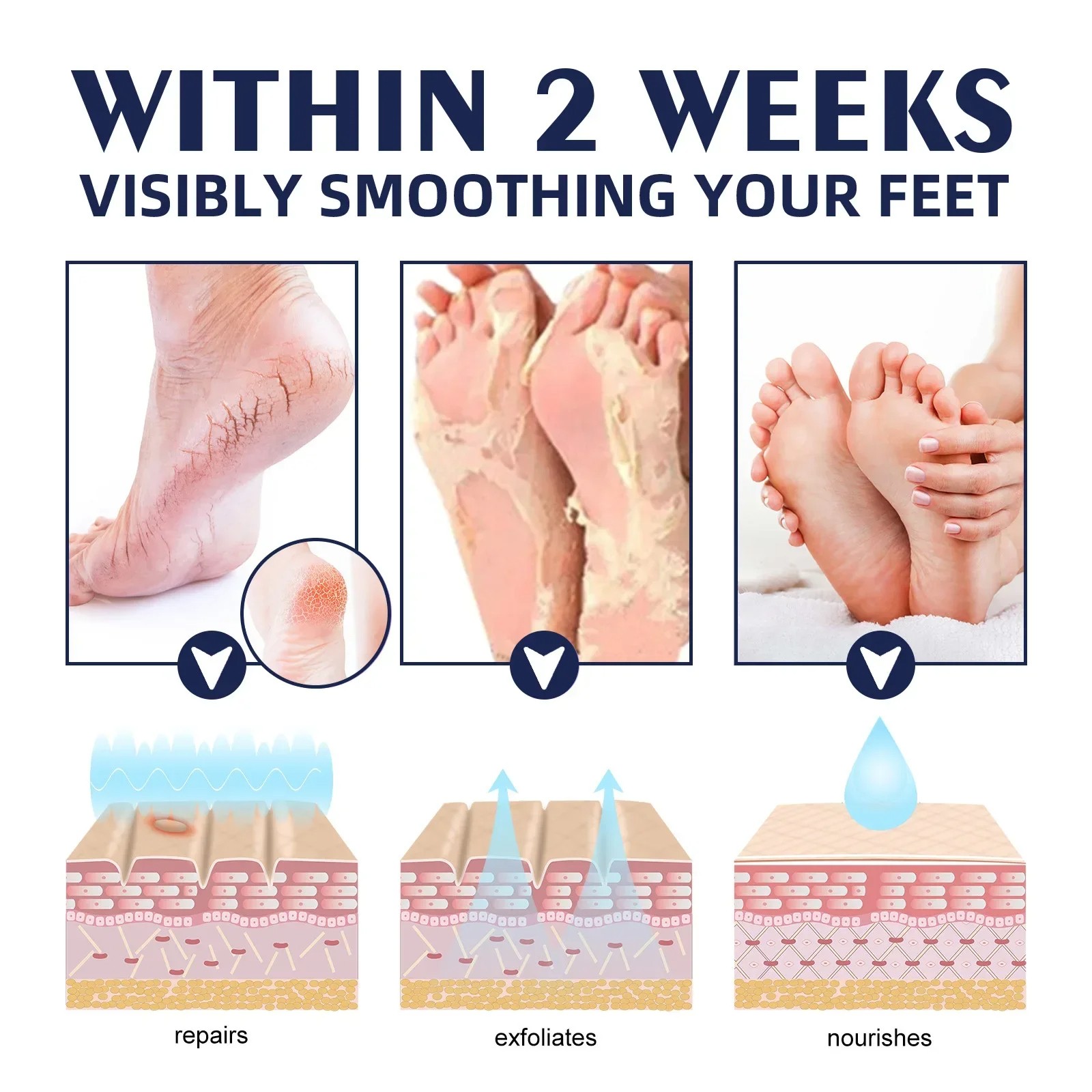 Anti-Drying Crack Hand and Foot Care Cream