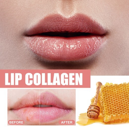 Watermelon Flavor Lip Balm Hydrating Freeze-dried Cracking