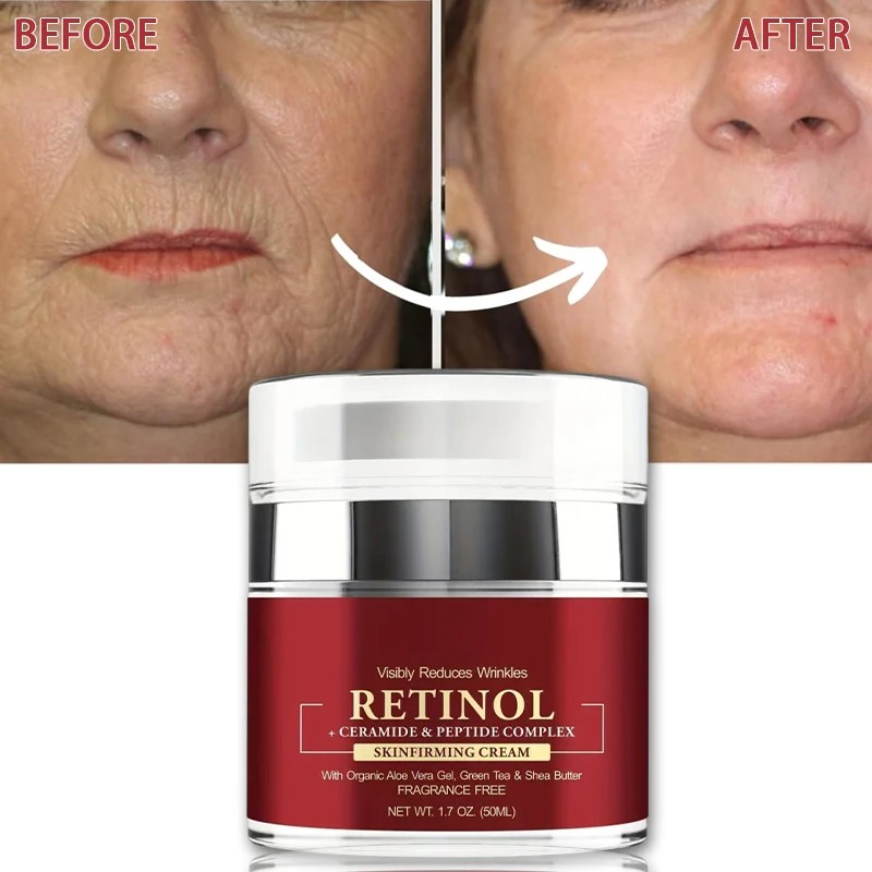 Instant Retinol Cream Wrinkle Remover - Firming, Lifting, and Anti-Aging Solution for Radiant Skin