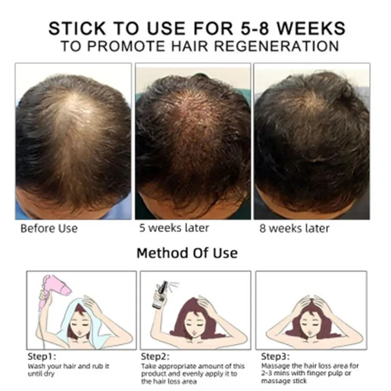 OEM Hair Care Essential Oil for Thicker, Healthier Hai