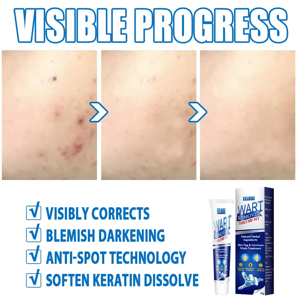 Liquid Skin Warts Ordinary Skin care lotion