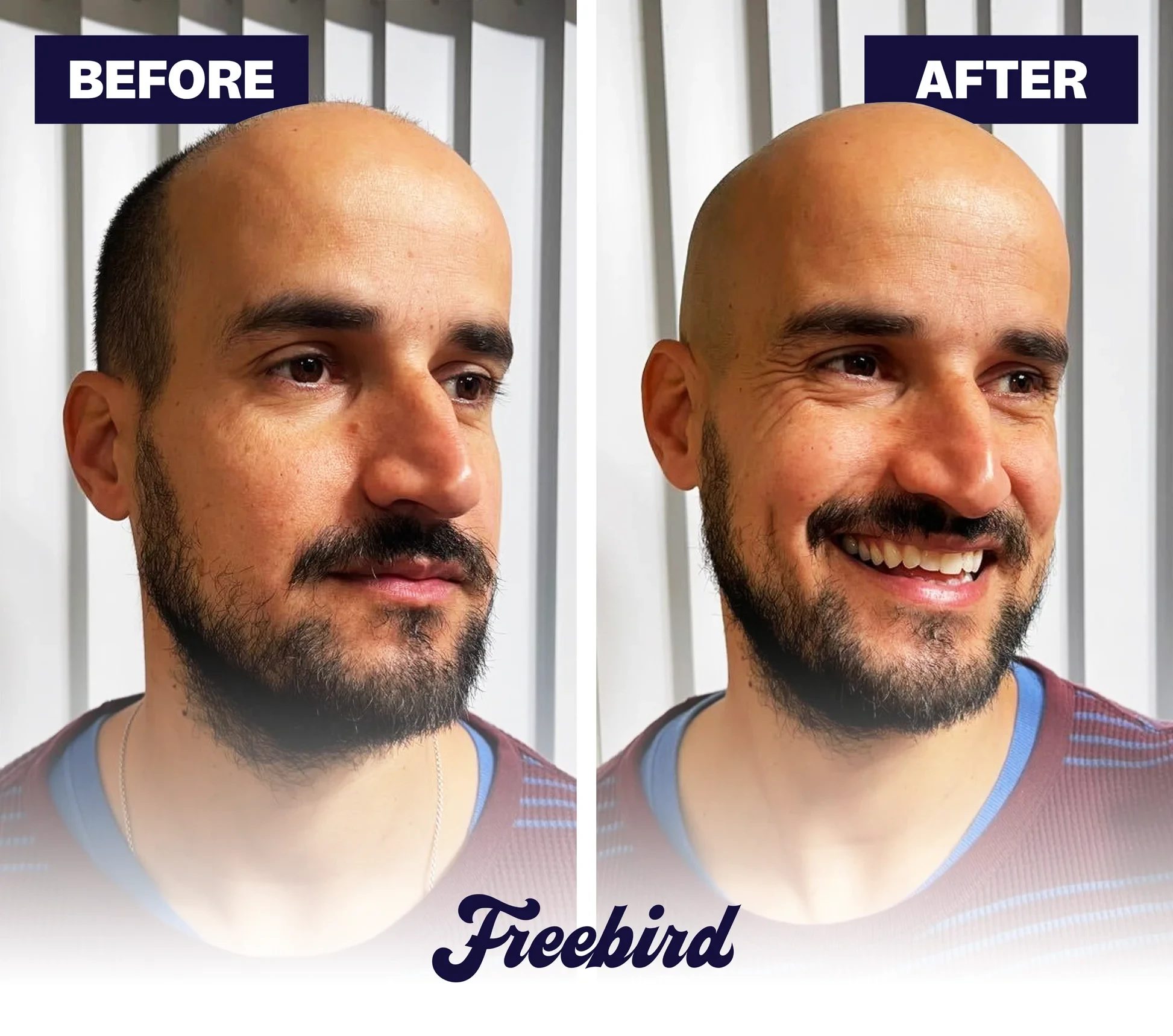 Full-Body Shaving Made Simple Head, Face, Body & Below the Waist