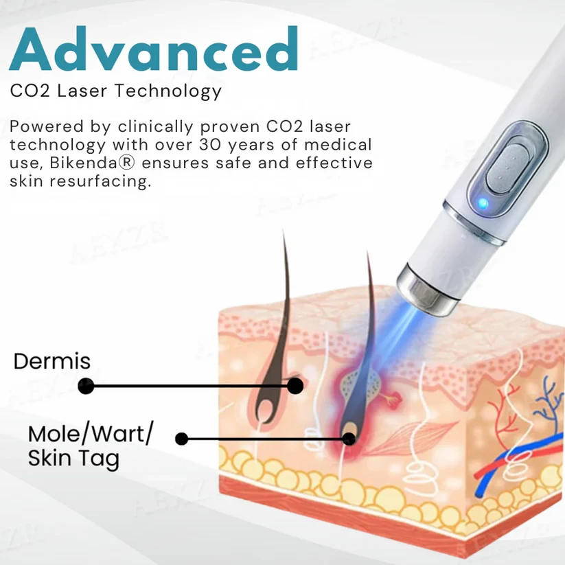 Bikenda Non-Invasive Mole and Wart Removal Laser Pen