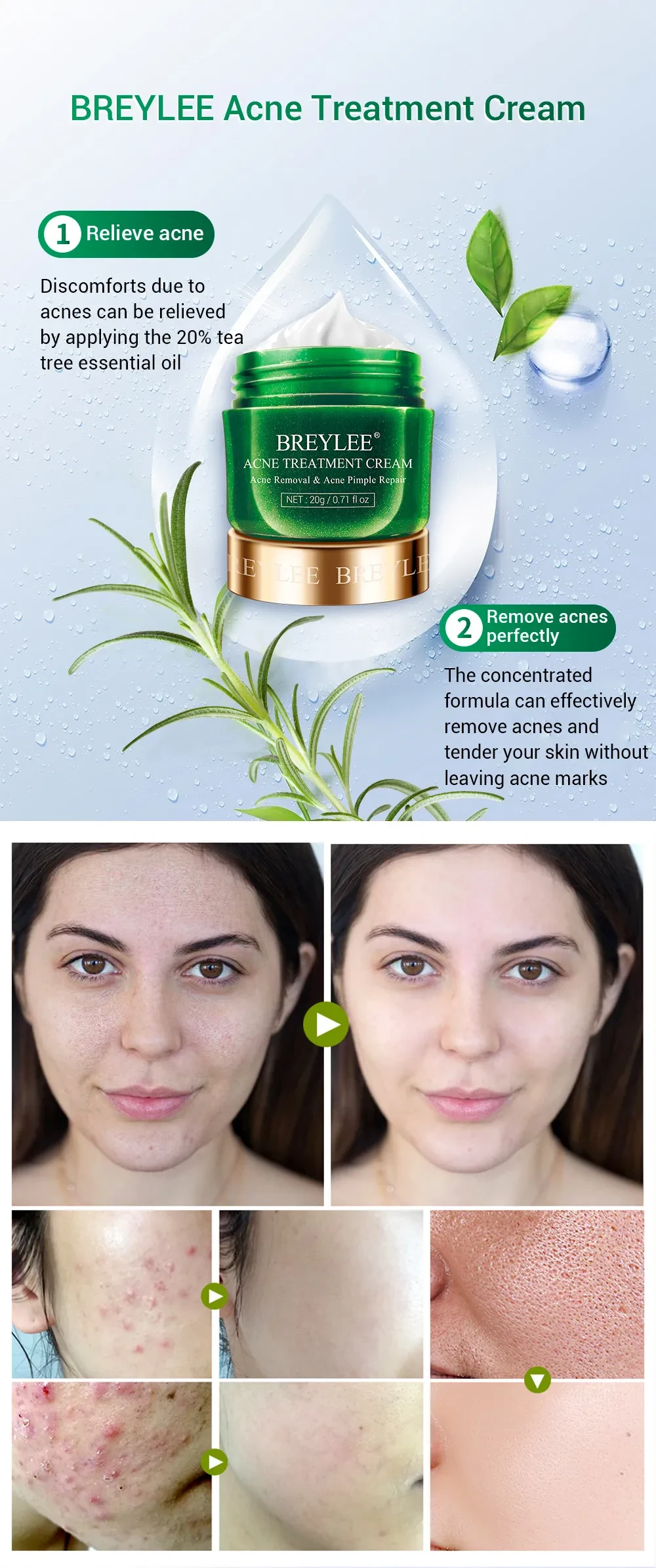 Tea tree acne cream moisturizing acne cream